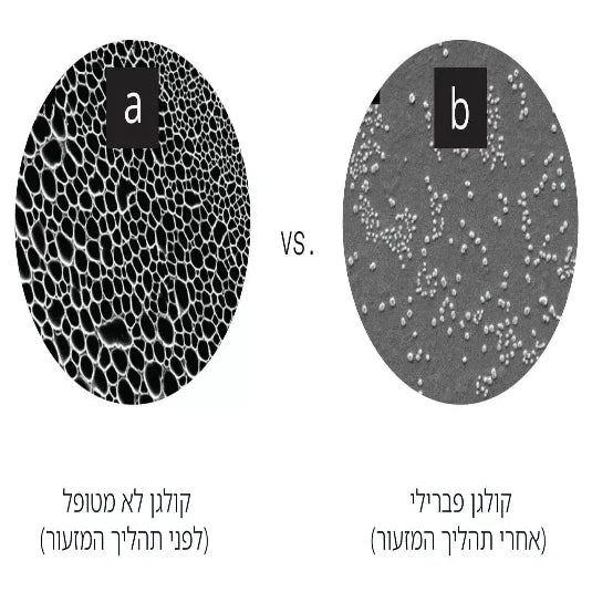 למרוח או לבלוע? האם תוספי תזונה המכילים קולגן באמת עובדים? האם לקולגן במריחה יש יתרונות על פני כדורים? יצאנו לבדוק והתוצאות לפניכן